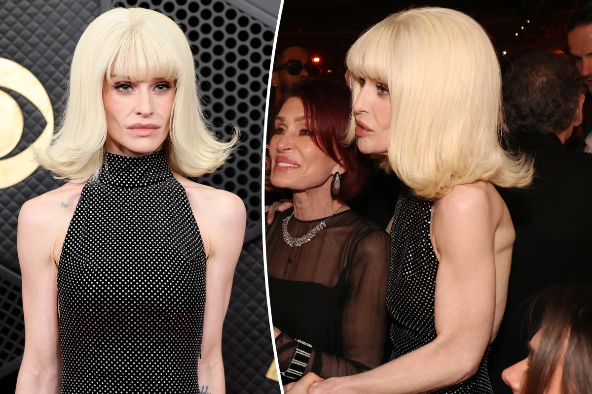 **Kelly Osbourne: Grammy’larda saç ekimiyle kilo kaybını gizledi**