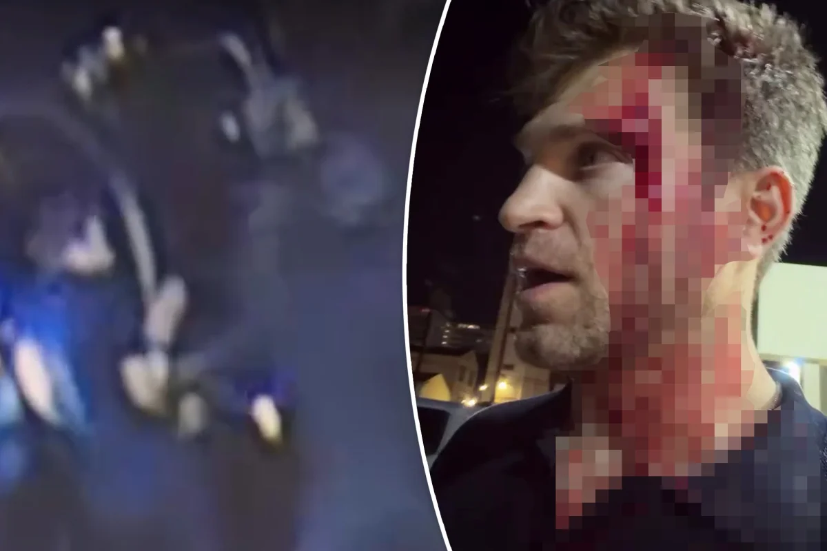 Keegan Allen, Hollywood'da silahlı soygun mağduru