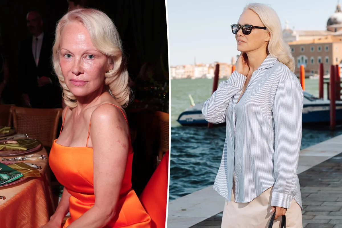 **Pamela Anderson: Hepatit C teşhisiyle "10 yıl hayatta kalma" öngörüsü**
